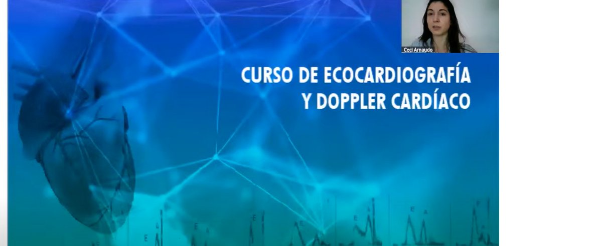 Puntos clave de Válvula aórtica discutiendo casos con Arturo Evangelista. Curso de Ecocardiografía e-cardioimage 2025.