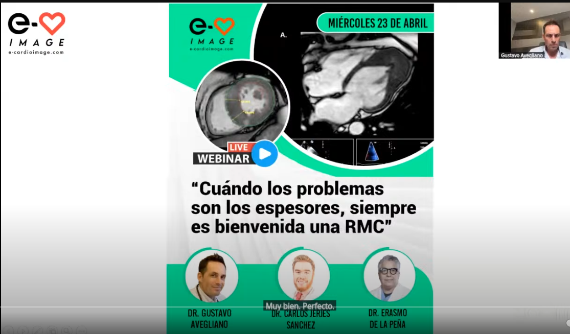 Webinar e-cardioimage: "Cuando los problemas son los espesores, siempre es bienvenida una RMC."