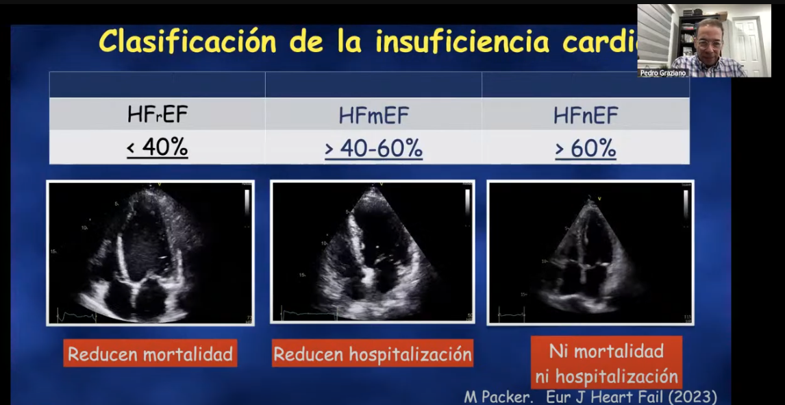 Masterclass Abierta del Curso de Ecocardiografía - Lo que necesitas saber hoy, de las MCP por el Dr. Pedro Graziano Sánchez.