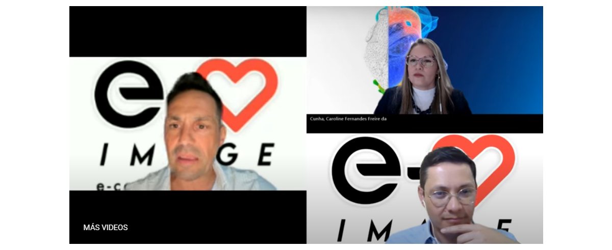 Webinar e cardioimage : Philips ¿Que tenemos de nuevo para valorar una Insuficiencia Mitral?