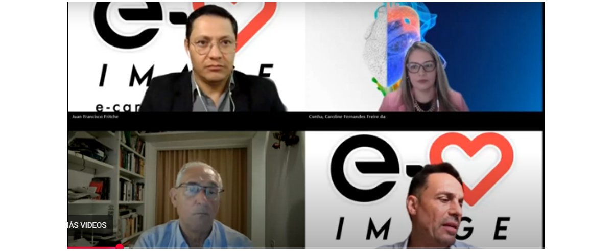 Webinar e-cardioimage / Philips. Casos de MCH. Buscando correlación entre mapas de Strain y la RMC.