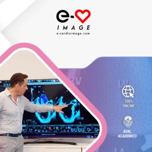 Curso de Ecocardiografía 3D Avanzada