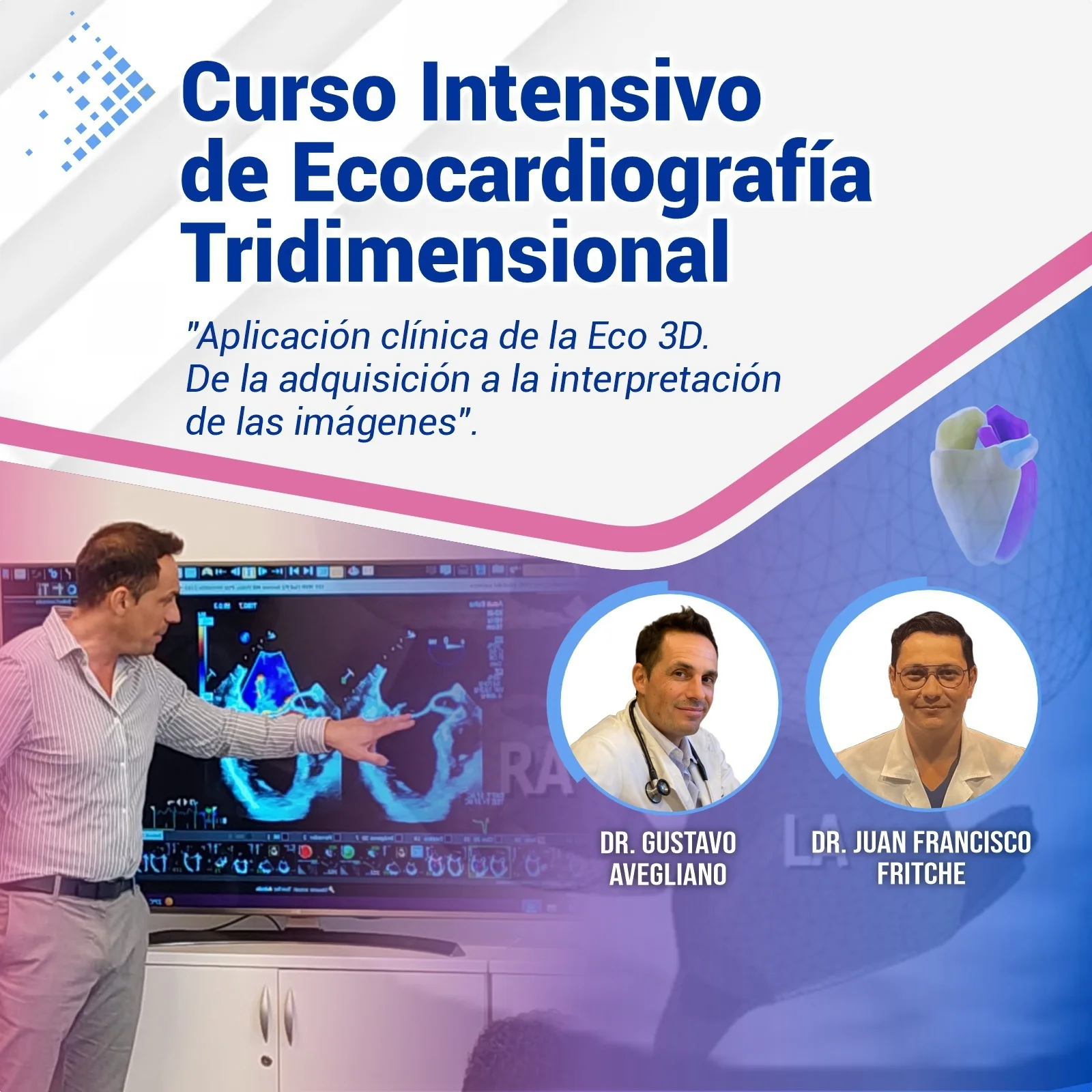 Curso de Ecocardiografía 3D Avanzada