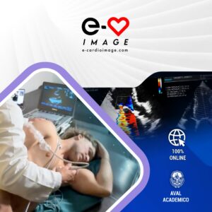 Mini Master de Ecocardiografía Básica