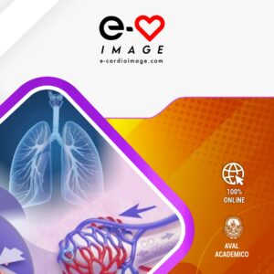 Curso Integral de Hipertensión Pulmonar