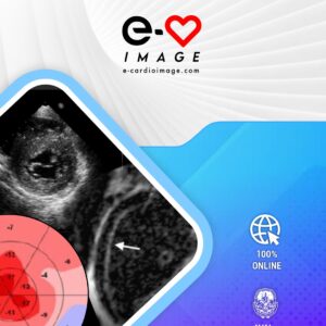 Mini Master de Amiloidosis Cardiaca