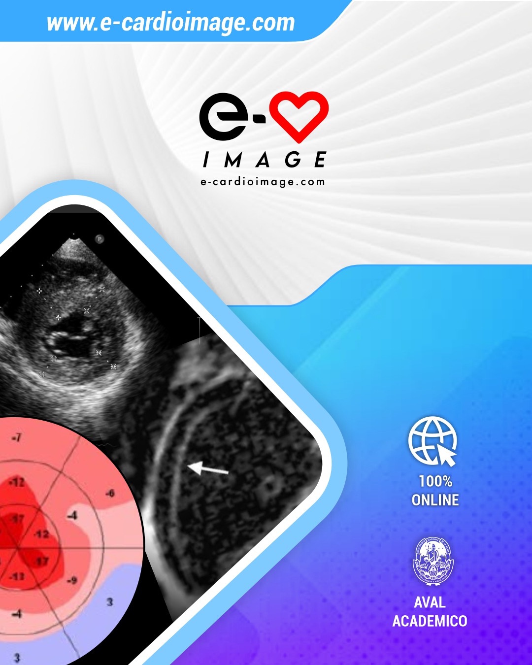 Mini Master de Amiloidosis Cardiaca